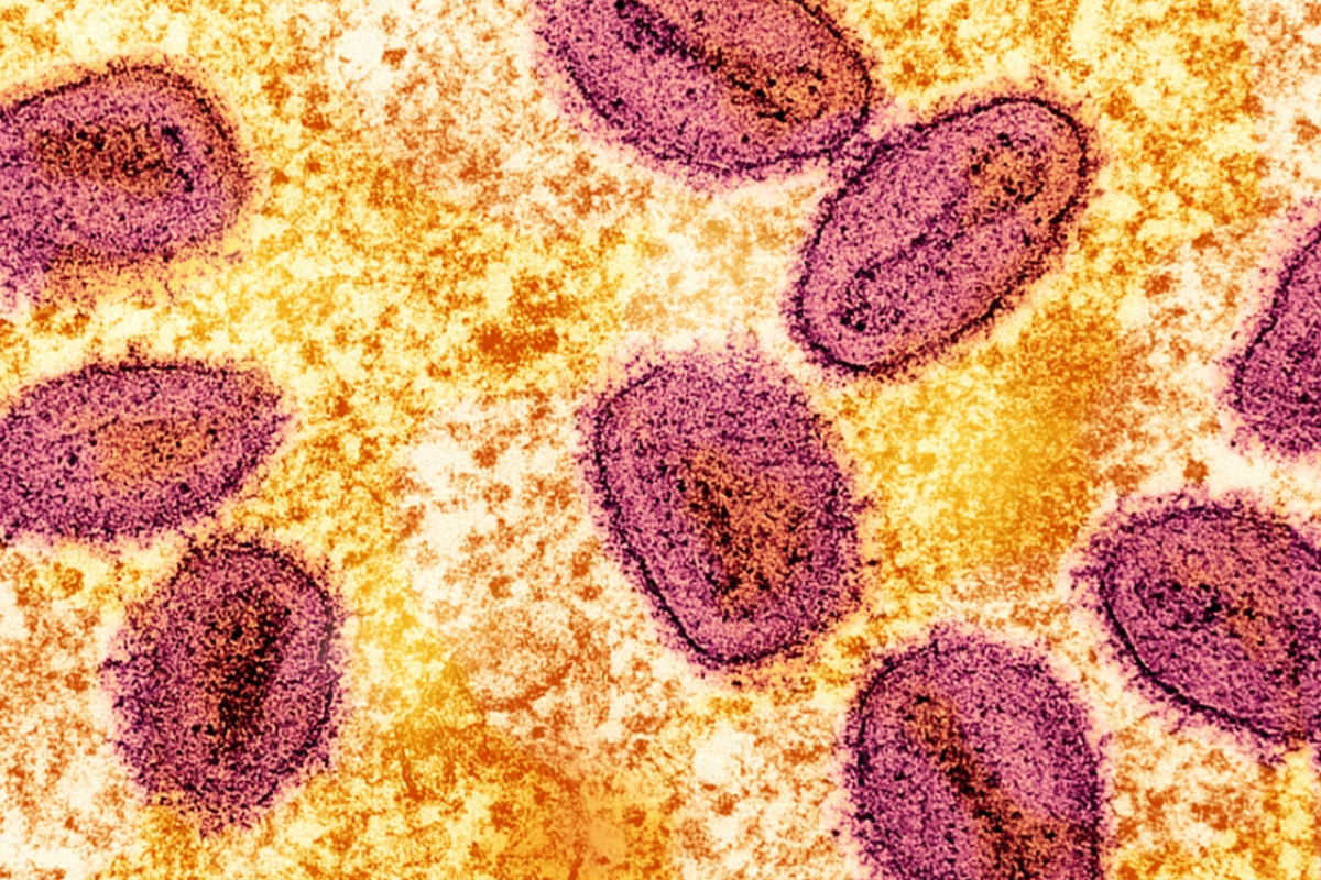 Boston Mpox Cases Creep Up As Pride Nears, City Ramps Up Shots