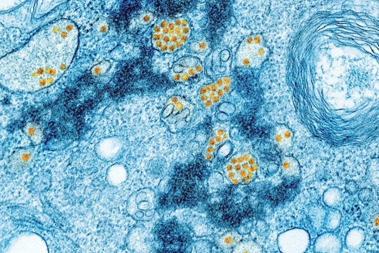 Brain-Eating Amoeba Lurking In Yellowstone And Lake Mead Hot Springs