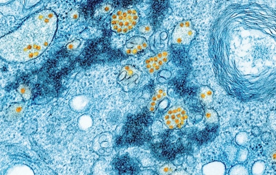 Brain-Eating Amoeba Lurking In Yellowstone And Lake Mead Hot Springs