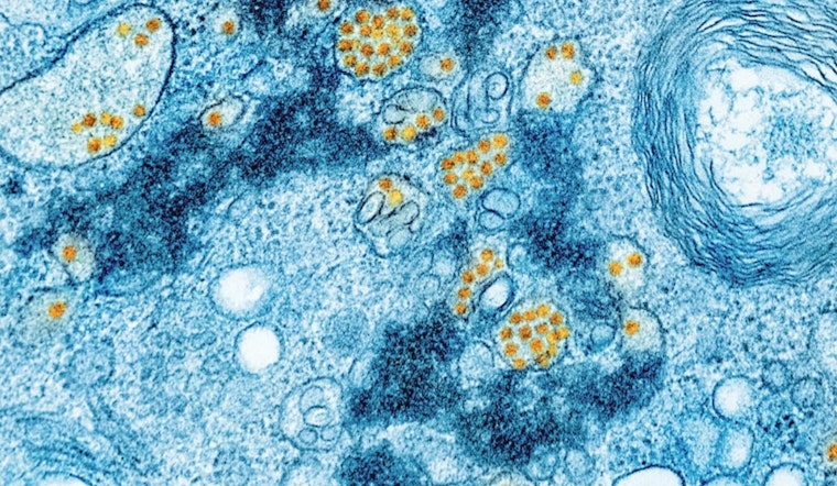 Brain-Eating Amoeba Lurking In Yellowstone And Lake Mead Hot Springs