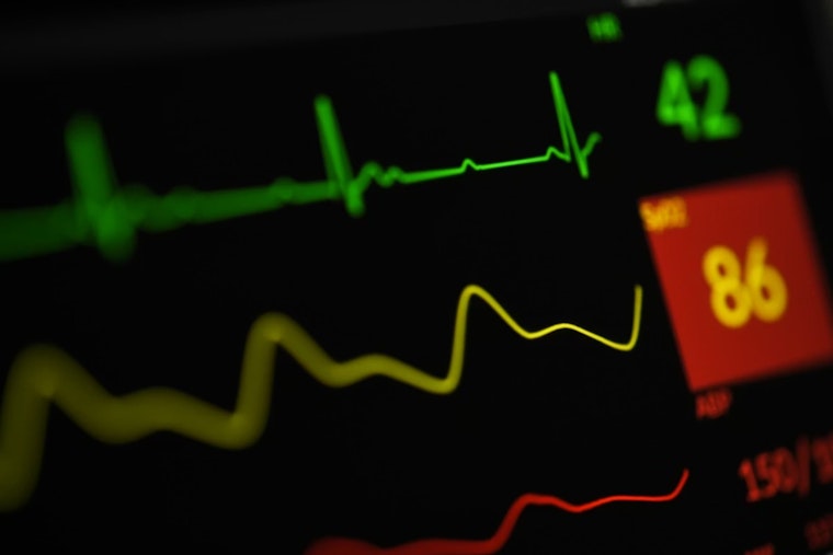 Broomfield Medics Roll Out High-Tech Heart Monitors In Colorado First