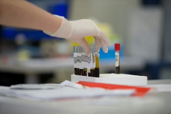Cedars-Sinai Blood Filter Buys Lifesaving Days For LA Pregnancies