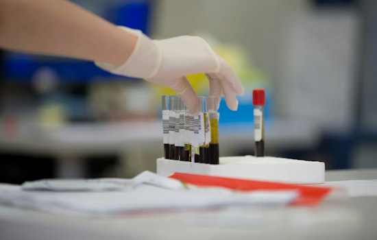 Cedars-Sinai Blood Filter Buys Lifesaving Days For LA Pregnancies