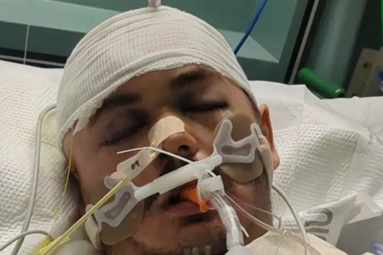 City Heights Alley Beating Leaves Young Resident With Devastating Brain Injury
