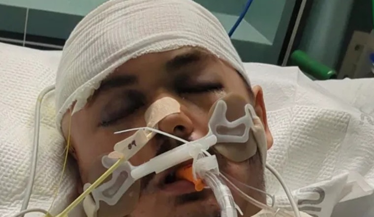 City Heights Alley Beating Leaves Young Resident With Devastating Brain Injury