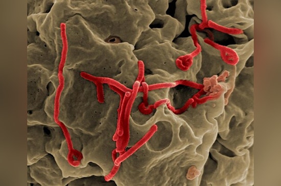 Ebola Toll Climbs In Congo As U.S. Health Teams Stand By