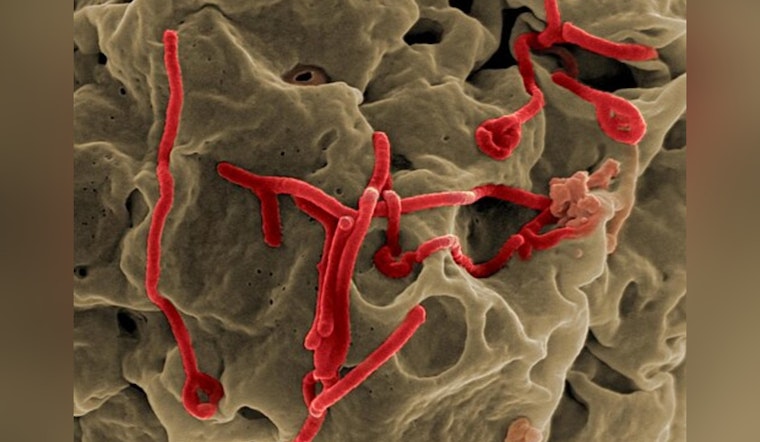 Ebola Toll Climbs In Congo As U.S. Health Teams Stand By