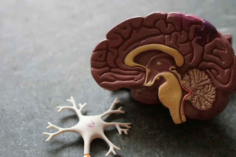 Eggs Over Easy On The Brain, Tampa Docs Weigh In On Alzheimer’s Study