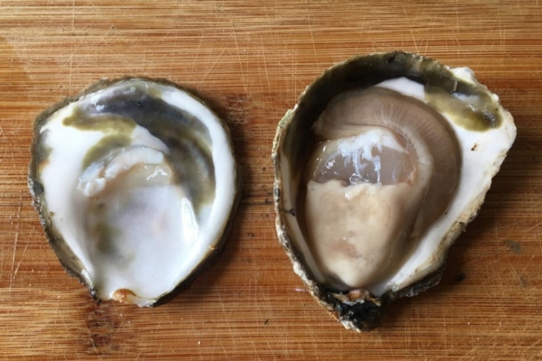 Former Jax Anchor Survives Raw Oyster Vibrio Nightmare