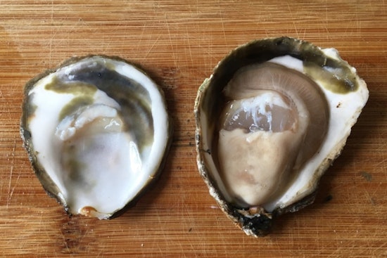 Former Jax Anchor Survives Raw Oyster Vibrio Nightmare