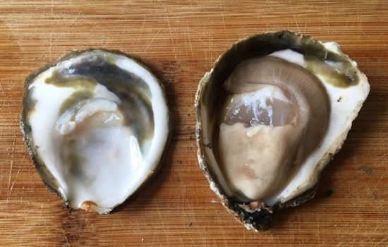 Former Jax Anchor Survives Raw Oyster Vibrio Nightmare