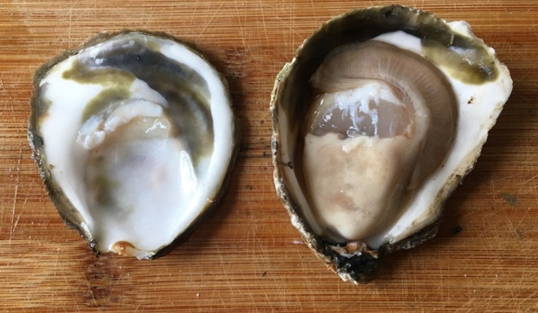 Former Jax Anchor Survives Raw Oyster Vibrio Nightmare
