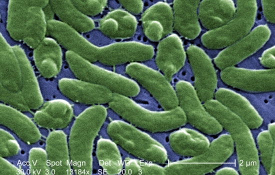 Hamptons Shellfish Scare: 'Flesh-Eating' Bacteria Spooks Buyers, Shuts Local Waters