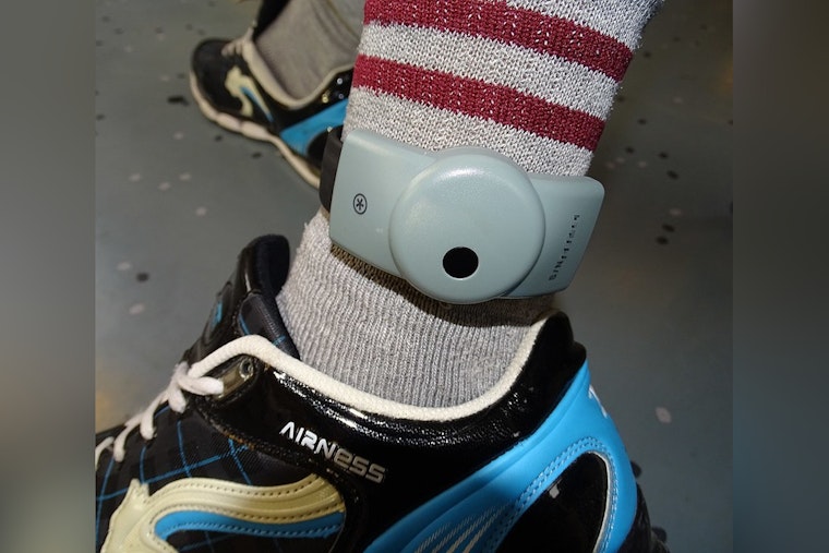 ICE Ankle Shackle Blamed in Grisly Leg Amputation of Indy Asylum Seeker