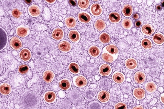 La Jolla Lab’s ‘Heat-Seeking’ B Cells Zero In On Solid Tumors