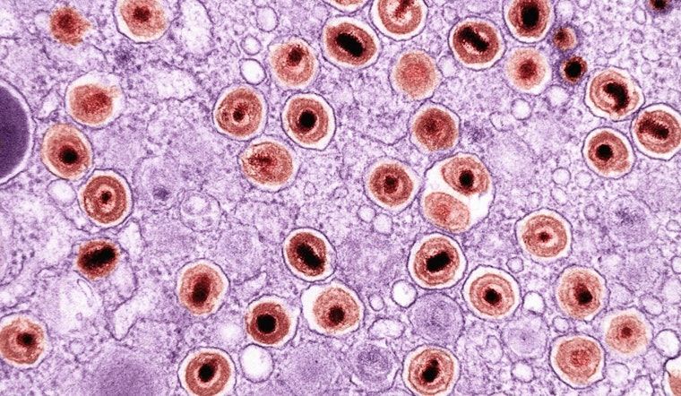 La Jolla Lab’s ‘Heat-Seeking’ B Cells Zero In On Solid Tumors