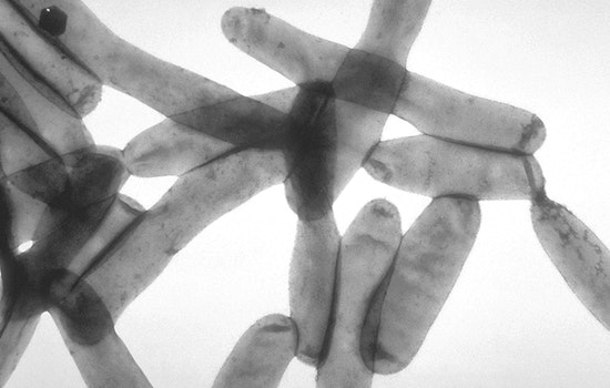 Legionnaires Scare At One Haven Plaza Has East Village Tenants On Edge