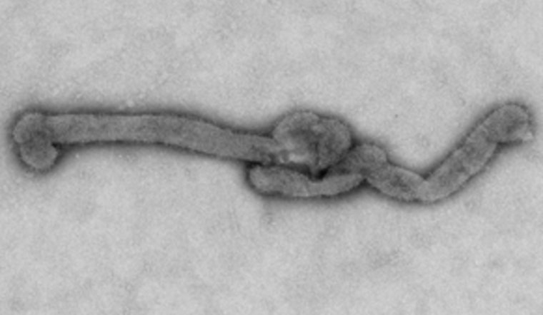 Long Island Man Cheats Death After Rare Bourbon Virus Tick Bite