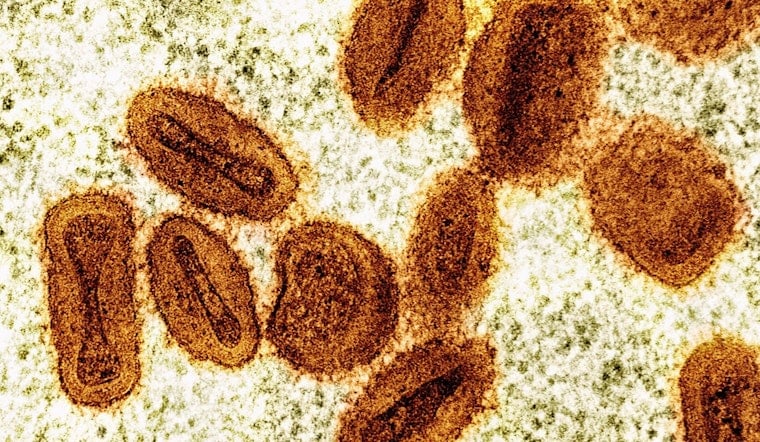 Mpox Pockets Pop Up Across Wisconsin As Health Officials Sound the Alert
