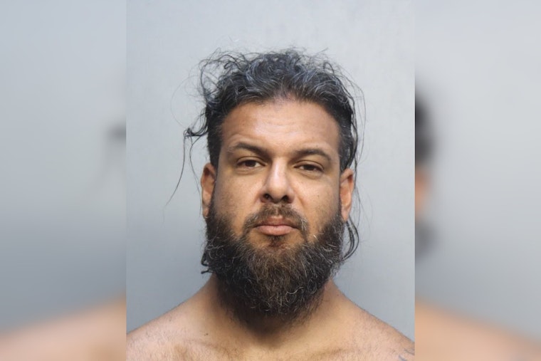 North Miami Boyfriend Busted In Burned Girlfriend Horror, Sex Assault Alleged