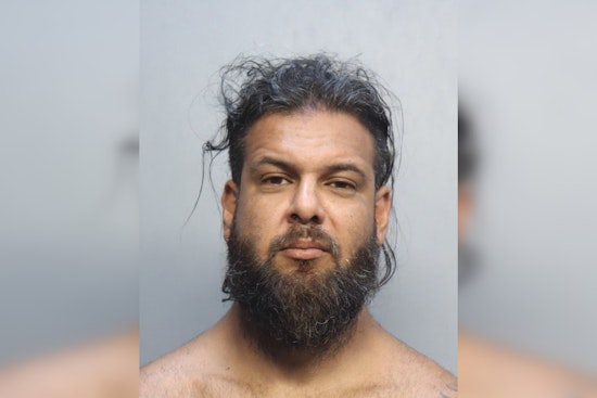North Miami Boyfriend Busted In Burned Girlfriend Horror, Sex Assault Alleged