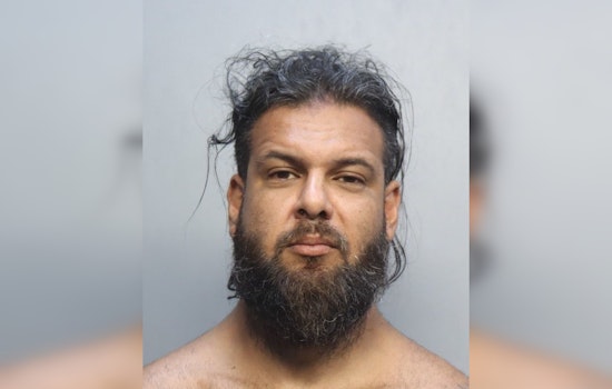 North Miami Boyfriend Busted In Burned Girlfriend Horror, Sex Assault Alleged