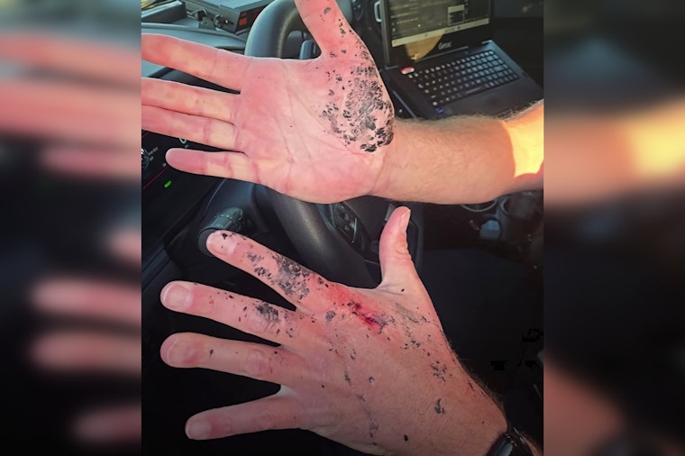 O'Fallon Cop Singes Hands Shielding Crash Victim From Flying Debris