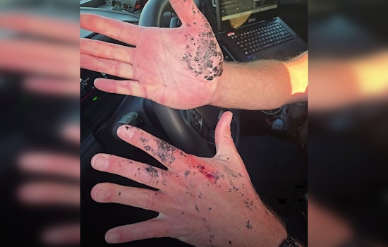O'Fallon Cop Singes Hands Shielding Crash Victim From Flying Debris