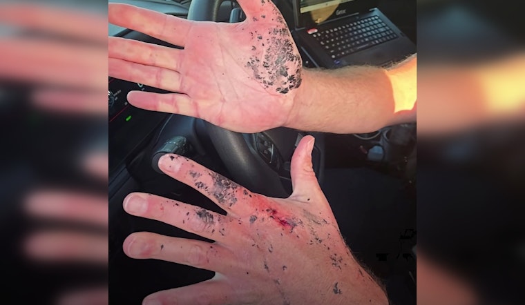 O'Fallon Cop Singes Hands Shielding Crash Victim From Flying Debris
