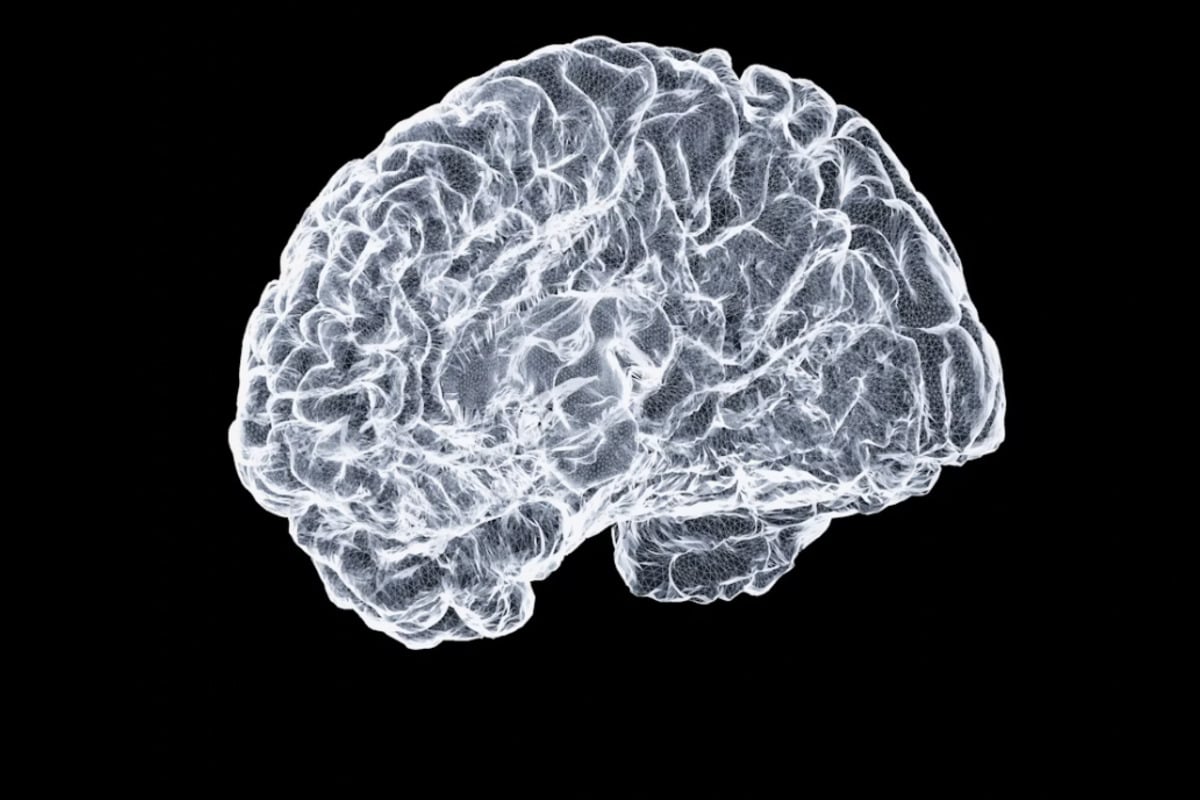 Portland Brain Freezing Startup Plots Leap From Pig To People