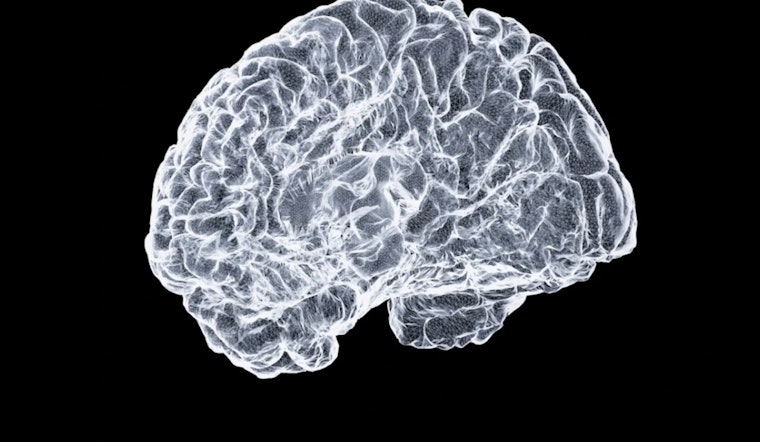 Portland Brain Freezing Startup Plots Leap From Pig To People