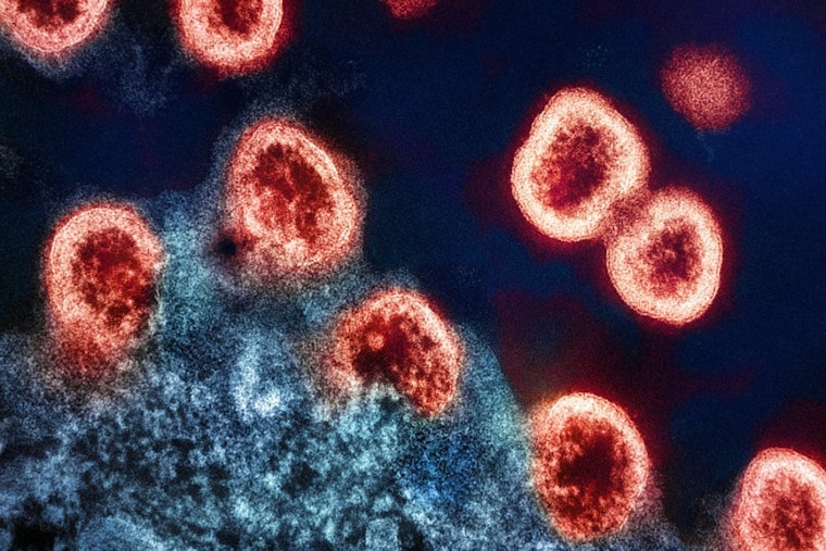 SF CAR-T Trial Lets Two HIV Patients Pause Daily Meds, Stuns Researchers