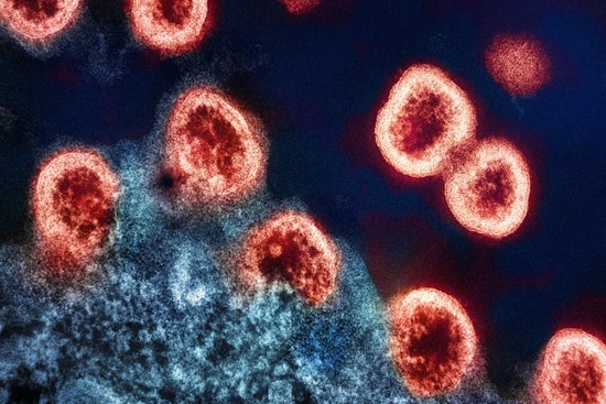 SF CAR-T Trial Lets Two HIV Patients Pause Daily Meds, Stuns Researchers