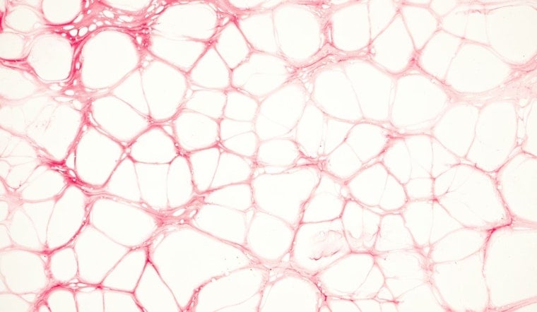 Tiny Ohio State ‘Nanochip’ Zaps Shredded Nerves Back To Life In Mice