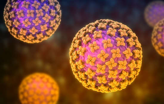 Winnebago Hantavirus Probe Not Linked To Cruise Ship