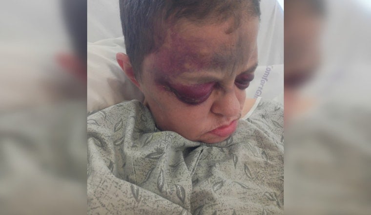Bruised And Hospitalized, Midwest City Mom’s Nursing Home Stay Sparks Probe