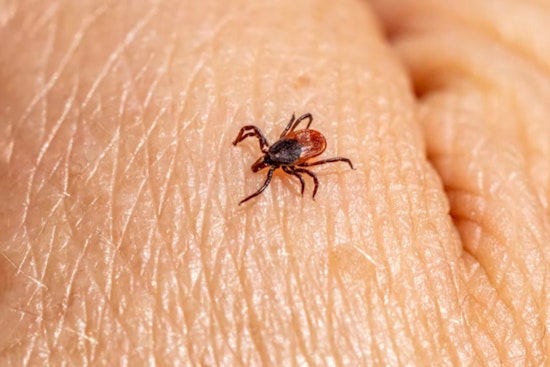 Concord Outdoorsman in Brutal Fight With Rare Tick Virus at Mass General