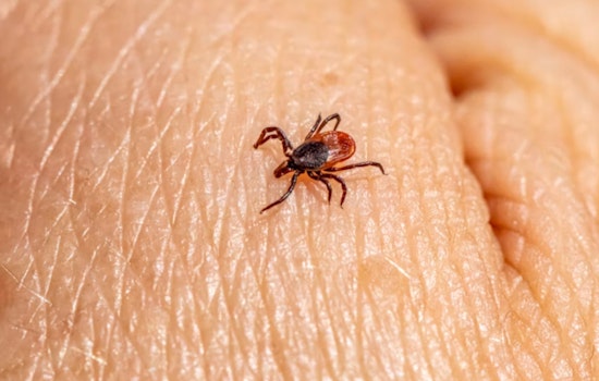 Concord Outdoorsman in Brutal Fight With Rare Tick Virus at Mass General