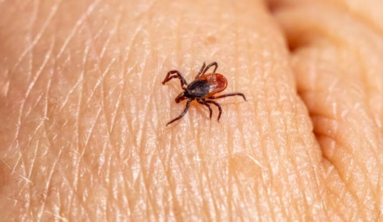 Concord Outdoorsman in Brutal Fight With Rare Tick Virus at Mass General