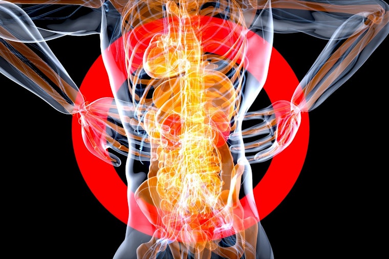 Hidden Spine Drainage System Has Charlotte Doctors Rethinking Back Pain
