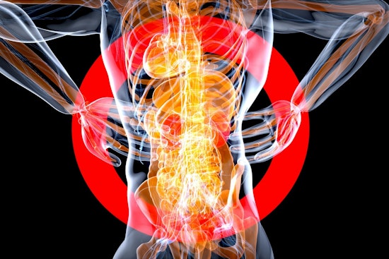 Hidden Spine Drainage System Has Charlotte Doctors Rethinking Back Pain