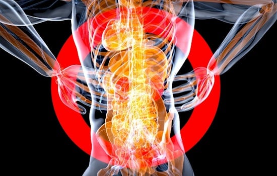 Hidden Spine Drainage System Has Charlotte Doctors Rethinking Back Pain