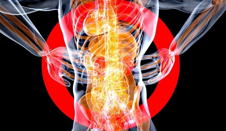 Hidden Spine Drainage System Has Charlotte Doctors Rethinking Back Pain