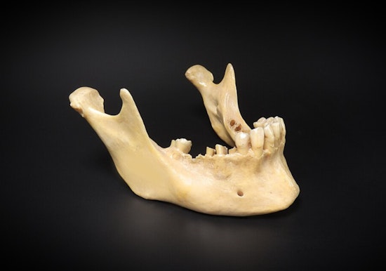 Jawbone Found at Linda Lane Beach in San Clemente