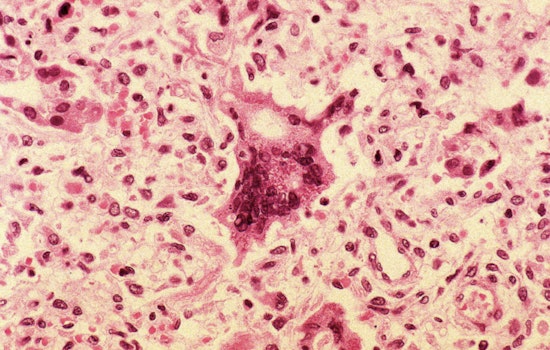 Measles Sneaks Back Into New York, Schumer Rips Feds Over ‘Reckless’ Response