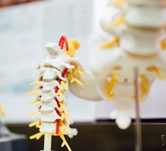 Mo Pols Axe Medicaid Back Cracks, Chronic Pain Patients Left Stiff