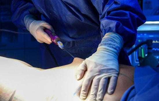 Nip, Tuck, Trouble: CDC Flags Hidden Dangers Of Surgery Trips