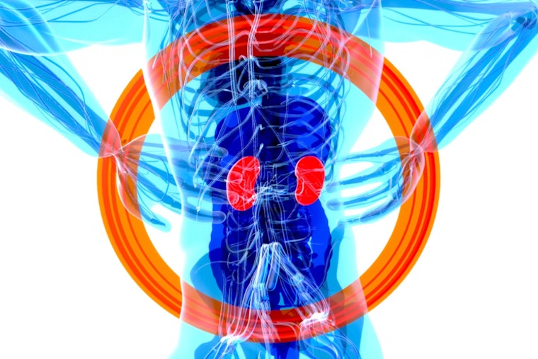 Penn CAR‑T Trial Teases New Hope For Kidney Failure Patients