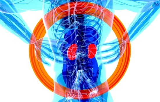 Penn CAR‑T Trial Teases New Hope For Kidney Failure Patients