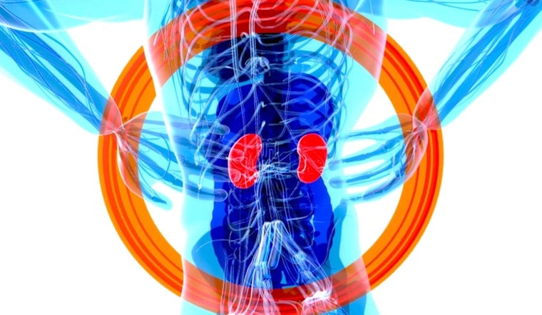 Penn CAR‑T Trial Teases New Hope For Kidney Failure Patients